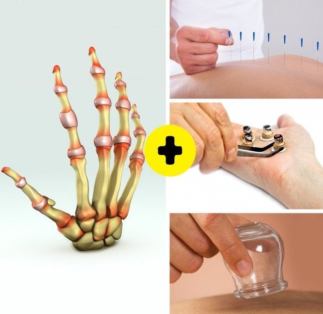 Bir Çok Hastalıktan Kurtaran Hacamatın Faydaları 5 hacamat hangi hastalıklara faydalıdır