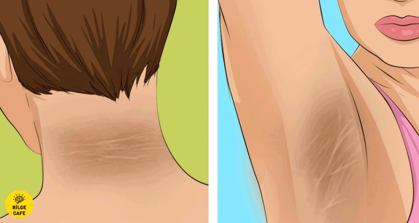 diyabetin erken tanisi icin bilinmesi gereken 9 belirti