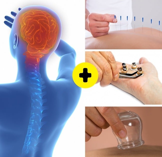 Bir Çok Hastalıktan Kurtaran Hacamatın Faydaları 14 hacamat nörolojik rahatsızlıklara iyi gelir mi