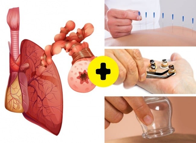 Bir Çok Hastalıktan Kurtaran Hacamatın Faydaları 3 hacamatın faydaları nelerdir