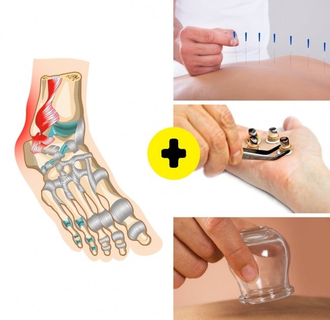 Bir Çok Hastalıktan Kurtaran Hacamatın Faydaları 6 hacamat eklem ağrısına iyi gelir mi