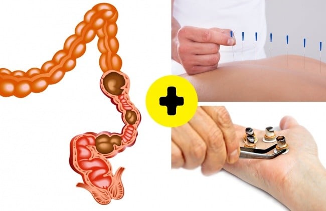 Bir Çok Hastalıktan Kurtaran Hacamatın Faydaları 8 hacamat sindirimi düzenler mi