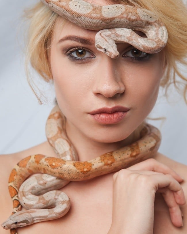 Doktorların Hakkında Hiçbir Şey Bilmediği 12 Tuhaf Hastalık ve Sendrom 13 Urbach-Wiethe