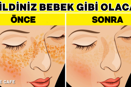 Cildinizin kusursuz görünmesini sağlamak ve lekelerden kurtulmak istiyorsanız 24 bebek gibi cilt
