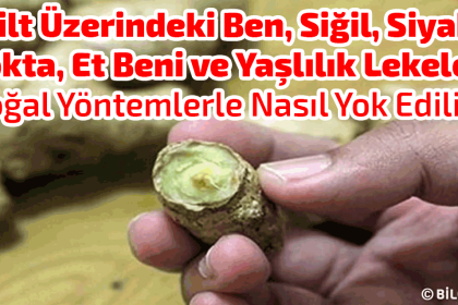 cilt uzerindeki ben sigil siyah nokta et beni ve yaslilik lekeleri dogal yontemlerle nasil yok edilir