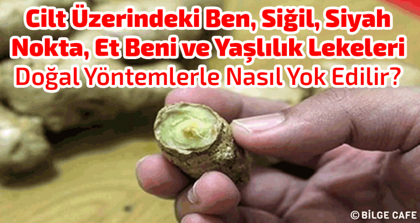 cilt uzerindeki ben sigil siyah nokta et beni ve yaslilik lekeleri dogal yontemlerle nasil yok edilir