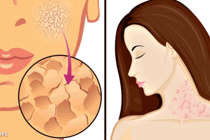 dus almayi ihmal ettiginizde basiniza gelecek 10 igrenc sey