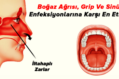 Boğaz Ağrısı, Grip Ve Sinüs Enfeksiyonlarına Karşı En Etkilisi 2 hastaliklara karsi