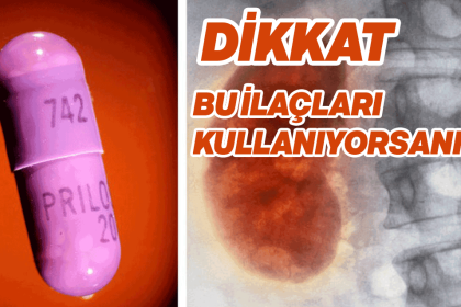 Mide Yanması İçin Kullandığımız İlaçlar Vücudumuzda Ne Gibi Hasarlara Yol Açıyor! 12 mide yanmasi icin kullandigimiz ilaclar vucudumuzda ne gibi hasarlara yol aciyorr