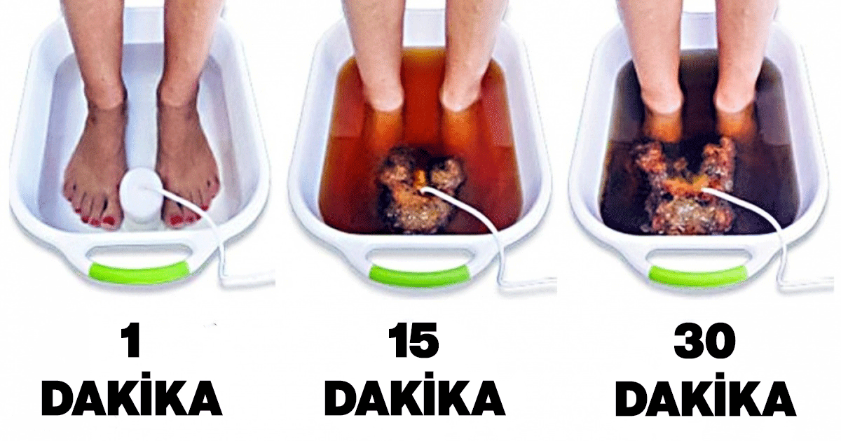 Vücudunuzu Toksinlerden Arındırıp Işıldamanızı Sağlayan 10 Şaşırtıcı Yöntem! 16 toksin temizleyici