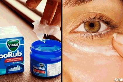 vicks vaporub kullanarak iyilestireceginiz 4 saglik sorunu
