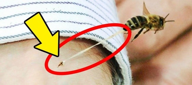 Okuyunca İnanamayacağınız 25 Garip Ama Gerçek Durum 9 ari