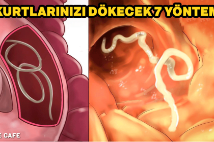 Kurtlarınızı Dökecek 7 Yöntem 2 bagirsak kurtlari