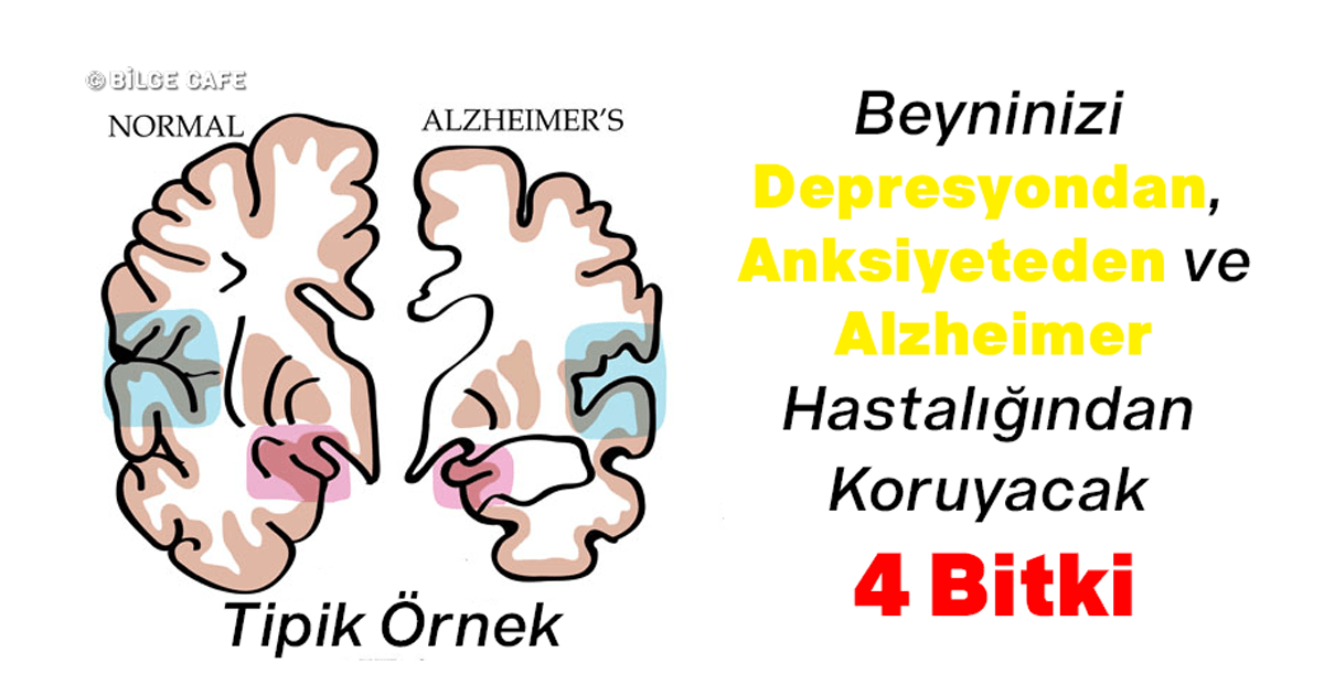 Beyninizi Depresyondan, Anksiyeteden ve Alzheimer Hastalığından Koruyacak 4 Bitki 16 beyinn2