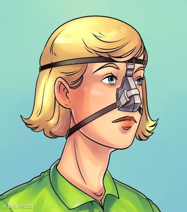 Geçmişte Kullanılan En Tehlikeli Olan 10 İcat 9 burun düzeltici