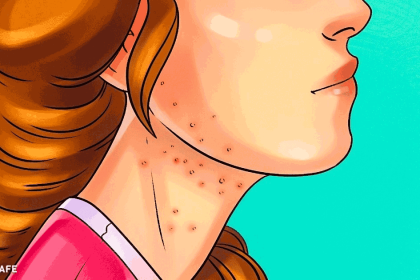 çok fazla şeker tükettiğinizin 9 işareti