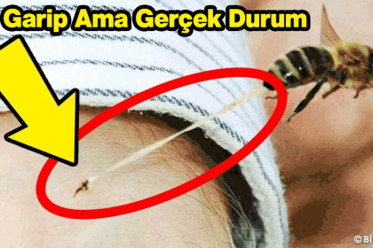 Okuyunca İnanamayacağınız 25 Garip Ama Gerçek Durum 4 garip ama gerçek durum