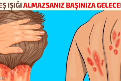 güneş ışığı almazsanız başınıza gelecekler