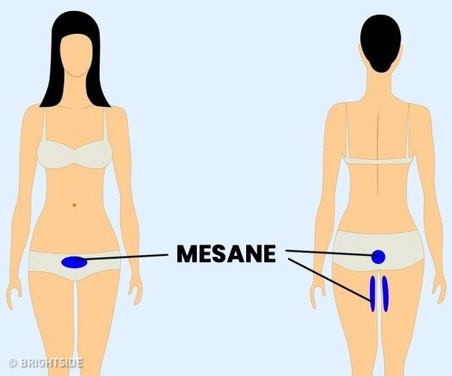 mesane