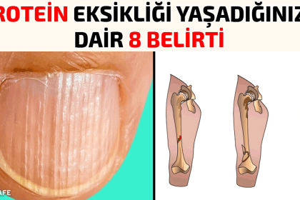 protein eksikliği belirtileri