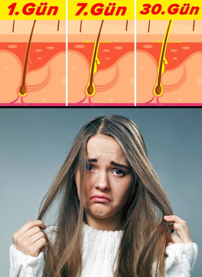 1 Hafta Duş Almadığınızda Yaşayacaklarınız 13 saclar1