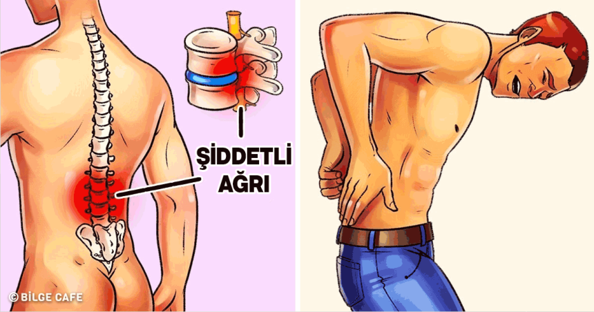 Ağrınızı Bıçak Gibi Kesen Hareket 1 şiddetli ağrı hareketleri