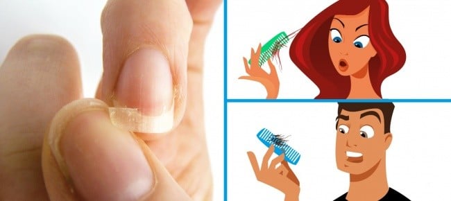 Kırılgan Tırnaklarınız, Saç Dökülmeleriniz ve Uykusuzluk Varsa Bunları Tüketmeye Başlayın 2 tırnak