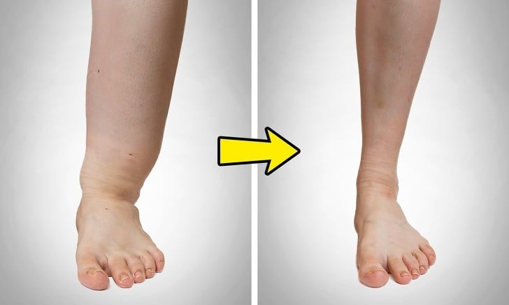 Bu Noktaya Bastırın Sağlık Sorunlarınıza Veda Edin! 7 hamile kadınlarda ödem oluşumu