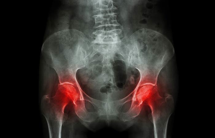 Ağrıların Dönüşeceği Hastalıklar 5 4.legenkemigi