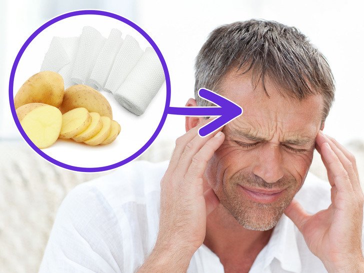Patatesin Çok Az Kişinin Bildiği 13 Kullanım Alanı 8 baş ağrısı