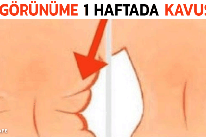 bel bölgesindeki yağlar