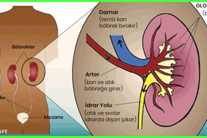 böbrek taşı nasıl düşer