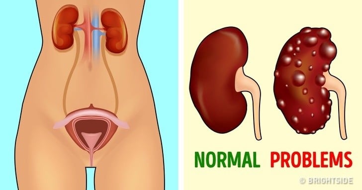 Her Yetişkinin Mutlaka Yapması Gereken 7 Tıbbi Test 9 böbrek