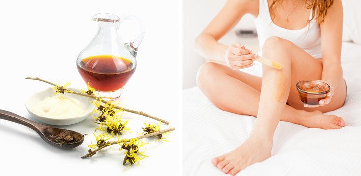 Varisli Damarlardan Kurtulmak İçin 10 Doğal Tedavi ve Egzersizler 7 cadı elalesi