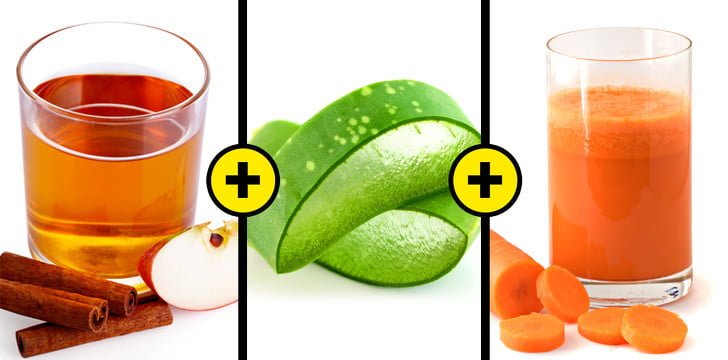 Varisli Damarlardan Kurtulmak İçin 10 Doğal Tedavi ve Egzersizler 6 elma sirkesi