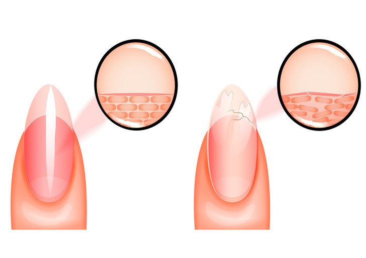 kırılgan tırnaklar