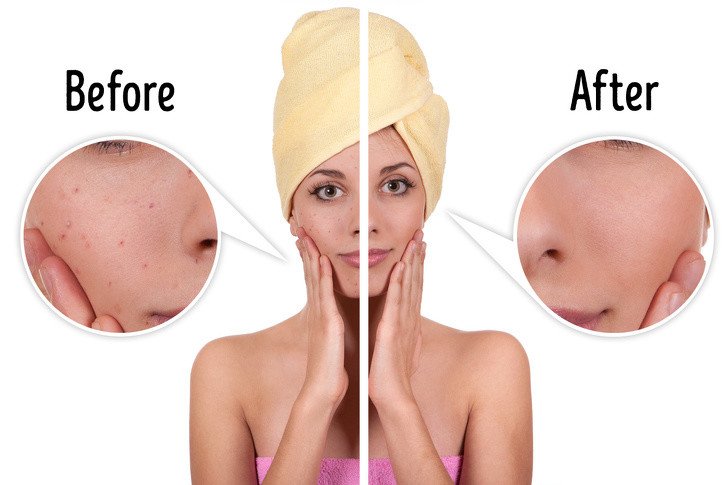 Patatesin Çok Az Kişinin Bildiği 13 Kullanım Alanı 10 leke