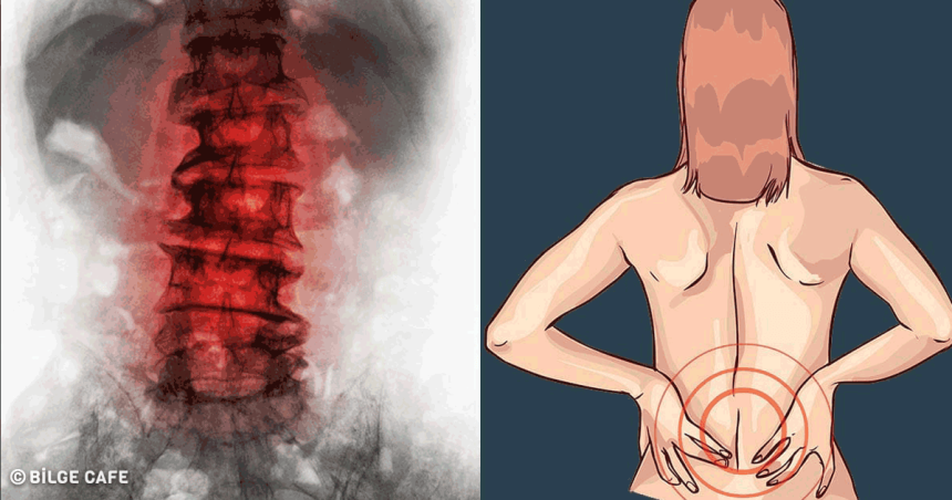 Osteoporoz belirtileri
