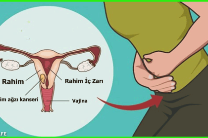 rahim ağzı kanseri belirtileri