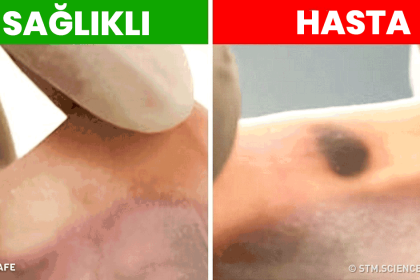 tehlikeli hastalıklara erken teşhis konuldu