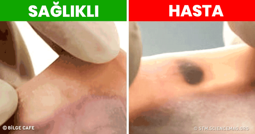 Tehlikeli Hastalıklara Erken Teşhis Koymanın Yolu Bulundu! 1 tehlikeli hastalıklara erken teşhis konuldu