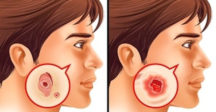 Her Yetişkinin Mutlaka Yapması Gereken 7 Tıbbi Test 3 yanak