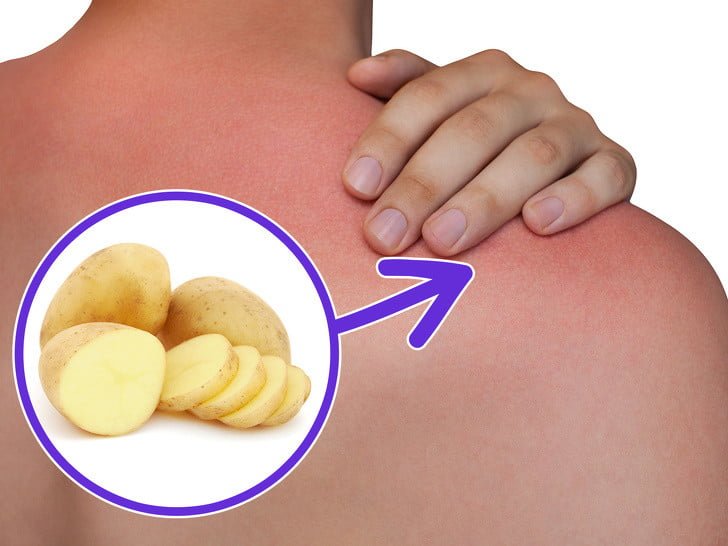 Patatesin Çok Az Kişinin Bildiği 13 Kullanım Alanı 4 yaniklar