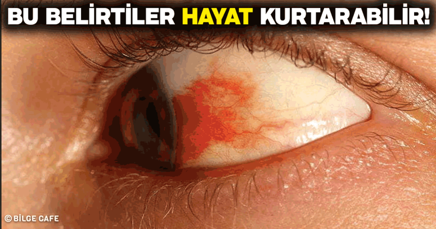 yüksek tansiyon belirtileri