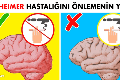 Alzheimer Hastalığını Önlemenin Kanıtlanmış 6 Yolu 12 alzheimer