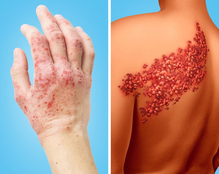 Kalbinizin Düzgün Çalışmadığına Dair 8 İşaret 9 deri