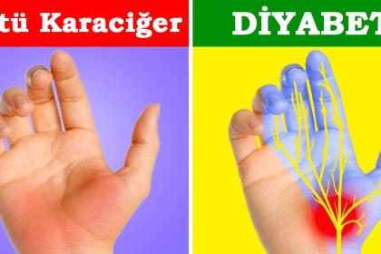Ellerinizin Size Sağlığınız Hakkında 7 Uyarısı 8 karaciger