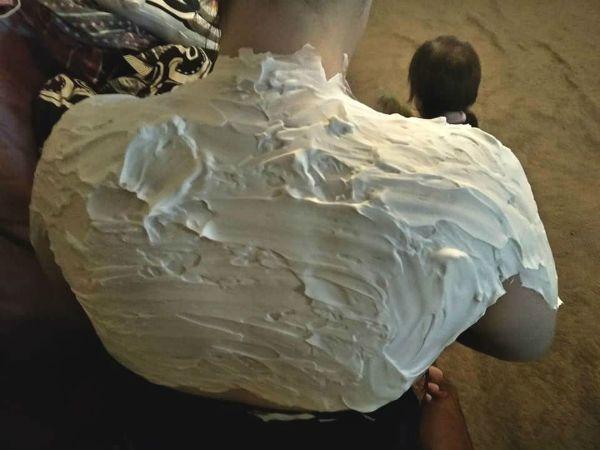 Güneş Yanığına Karşı Basit Ama Güçlü Bir Tedavi Yöntemi 4 köpüklü sırt