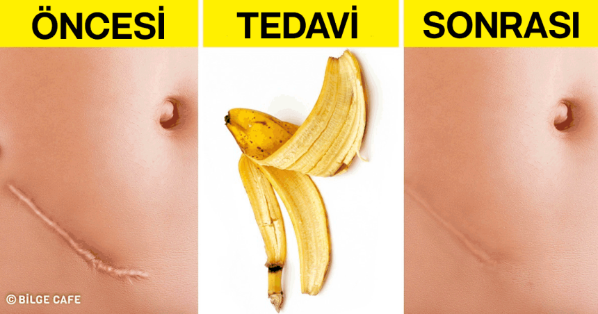 muz kabugunun kullanim alanlari