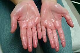 Ellerinizin Size Sağlığınız Hakkında 7 Uyarısı 3 terli eller